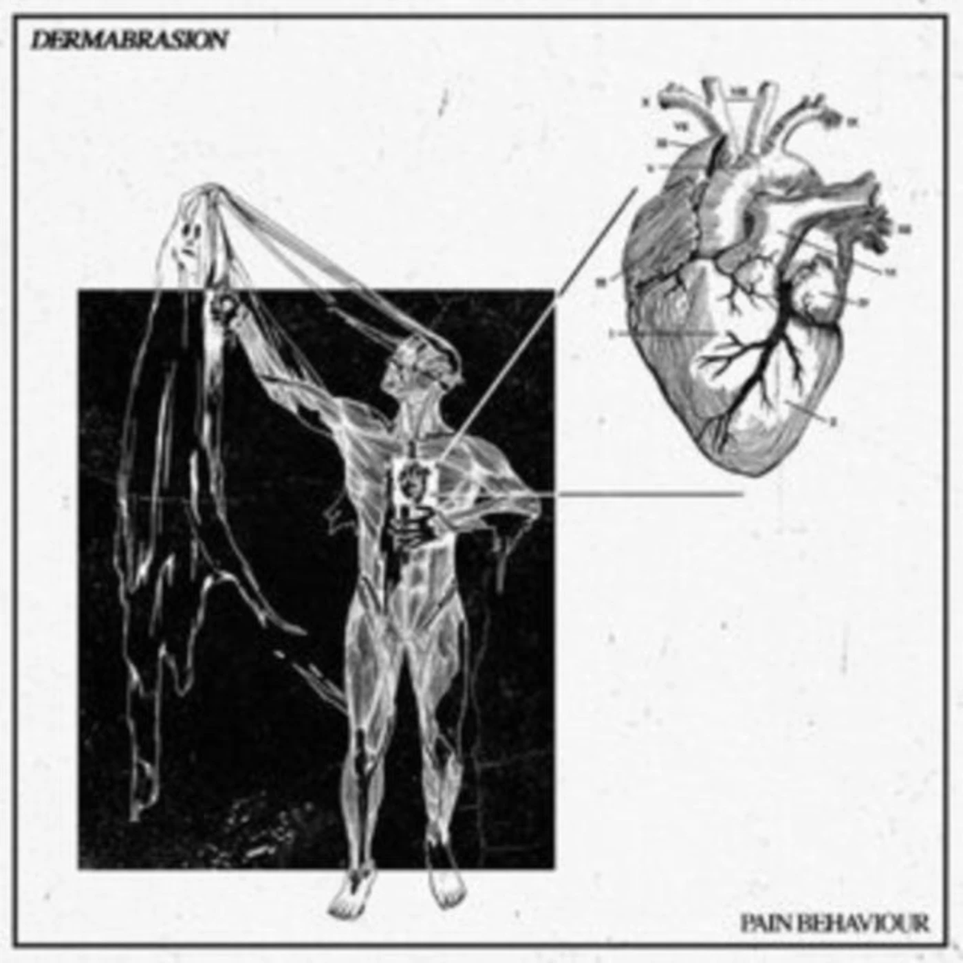 Dermabrasion CD - Pain Behaviour