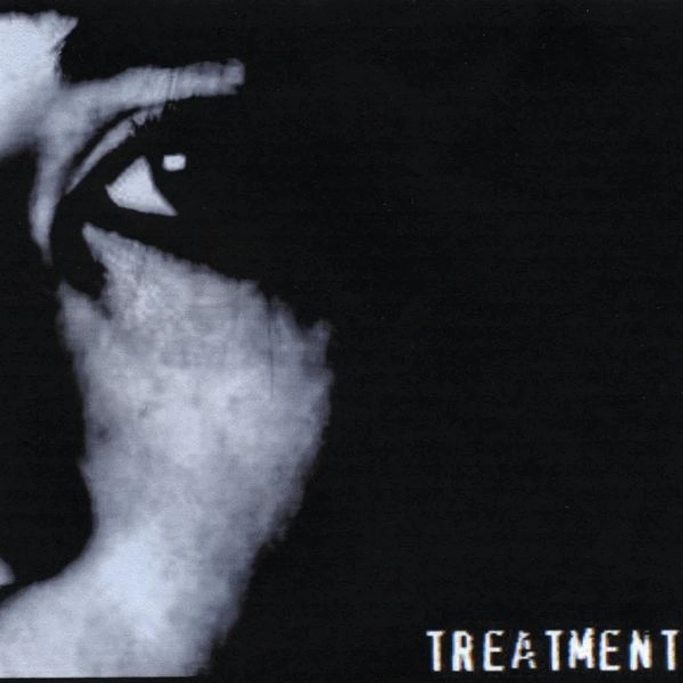 The Treatment MENTALMENTALITY CD