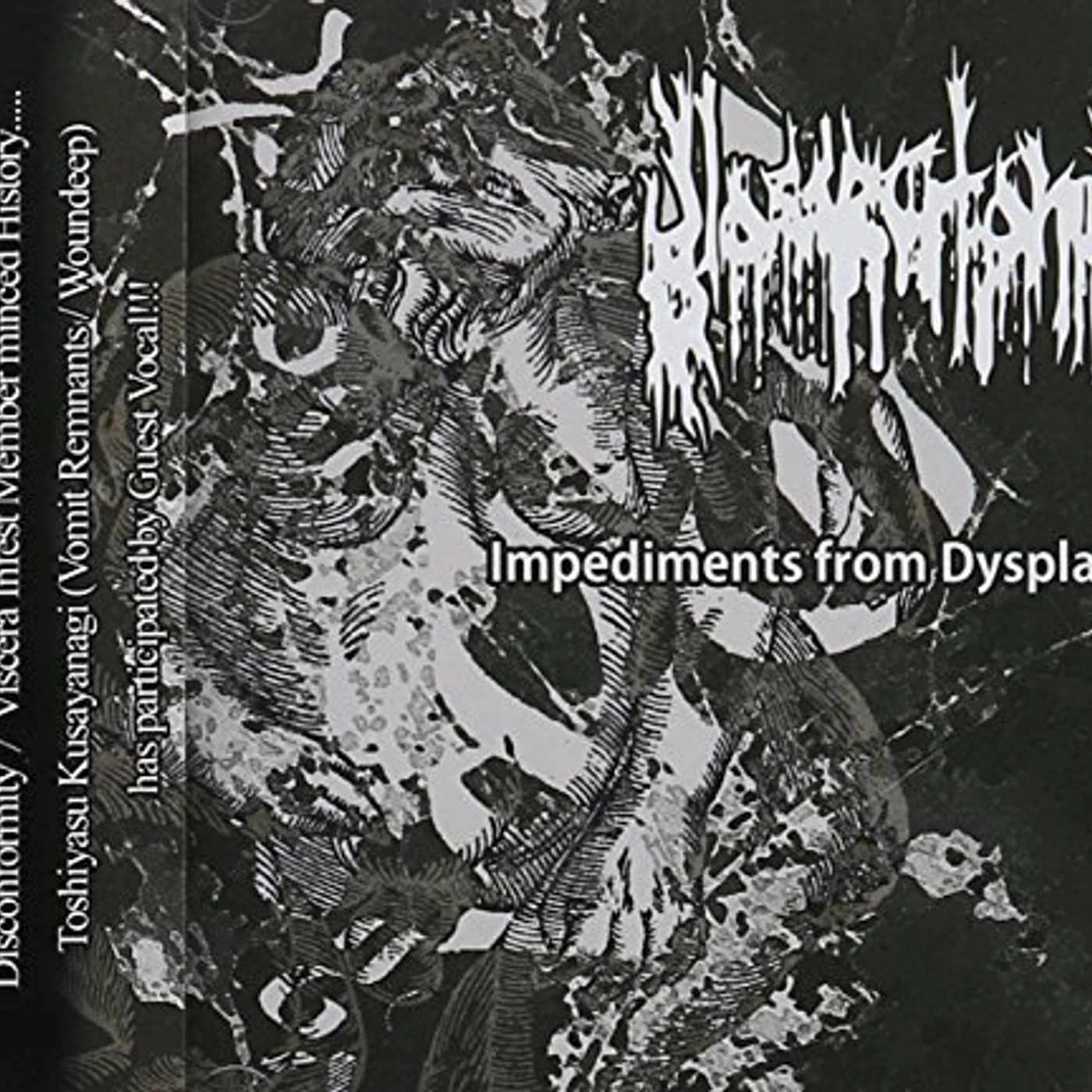 Glossectomy IMPEDIMENTS FROM DYSPLASIA CD