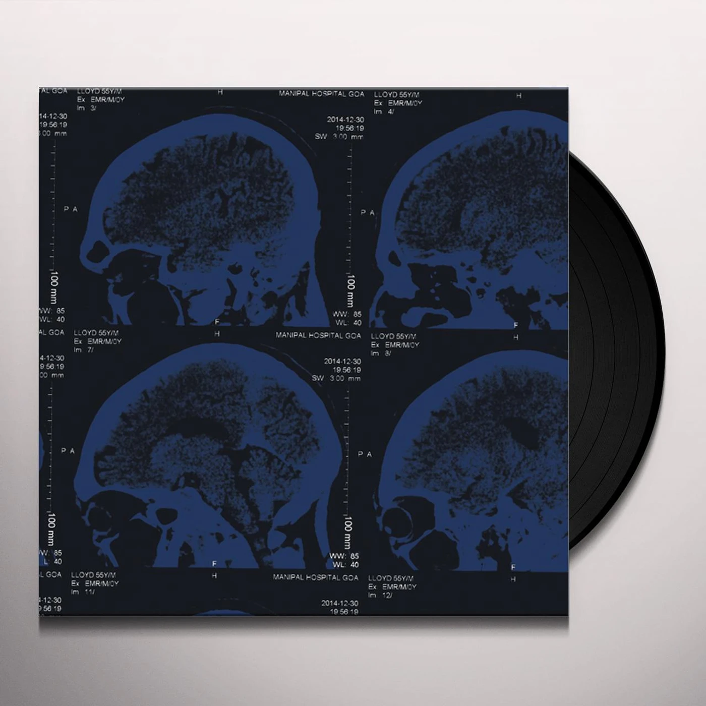 The Nightingales Mind over Matter Vinyl Record