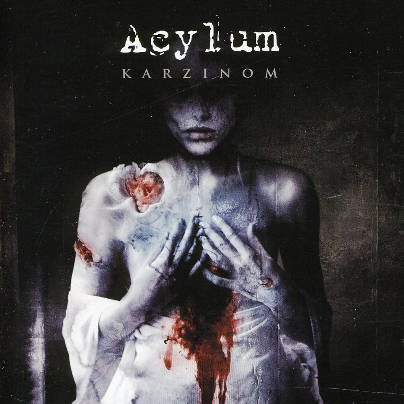 Acylum KARZINOM CD