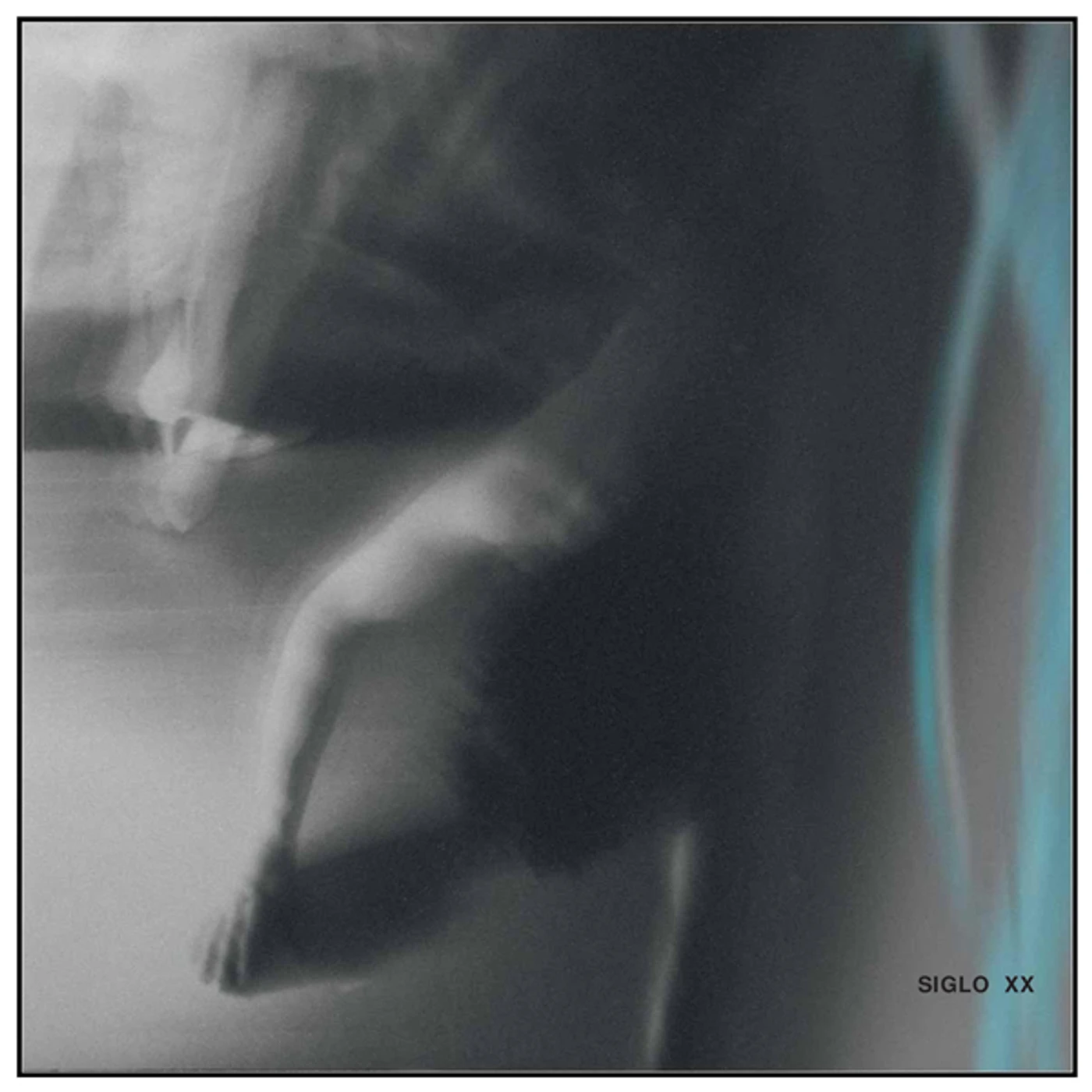 Siglo XX Answer Vinyl Record