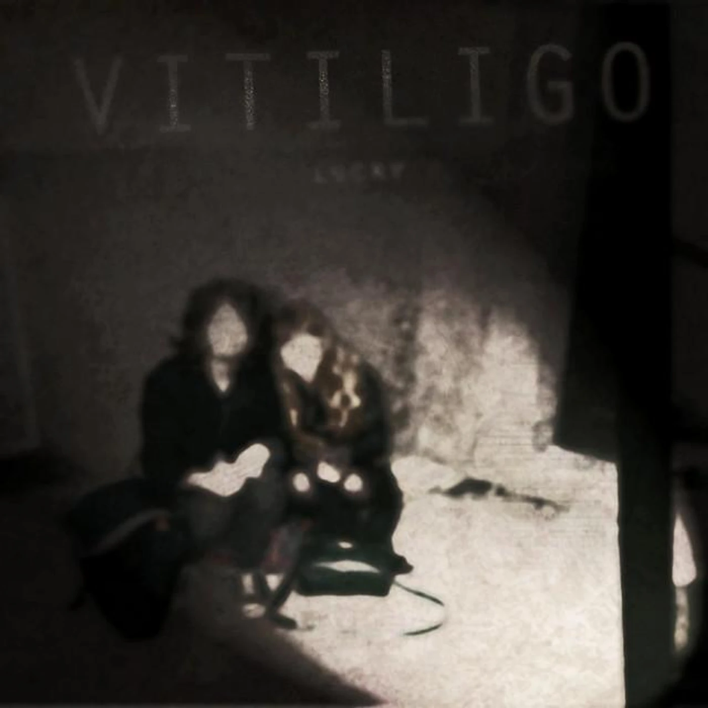 Vitiligo