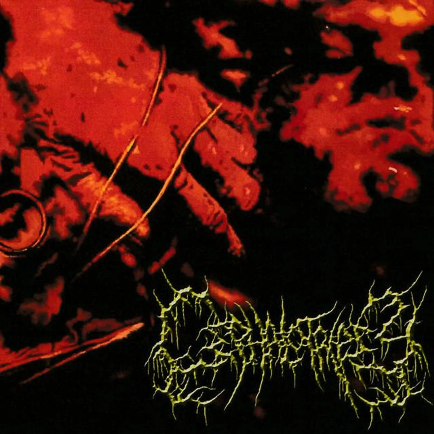 Cephalotripsy Brand Page