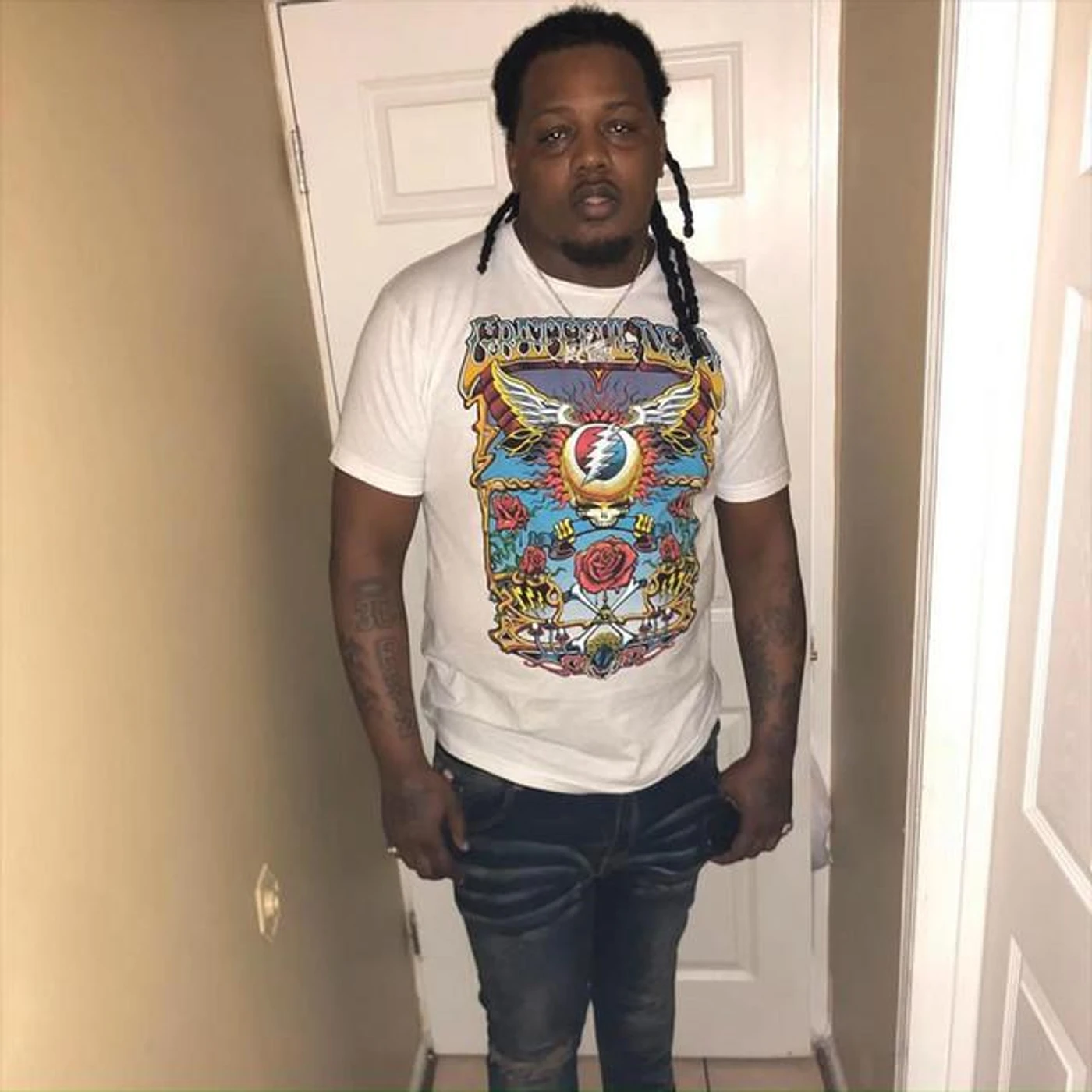 FBG