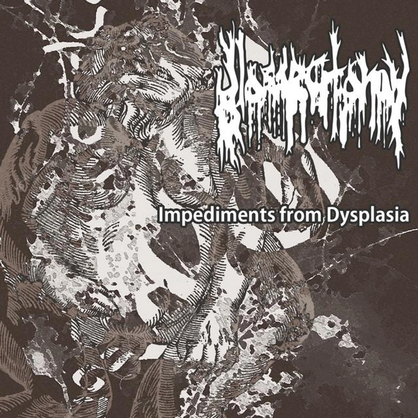 Glossectomy Brand Page