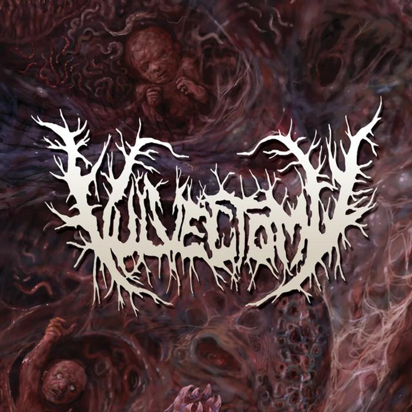 Vulvectomy Brand Page