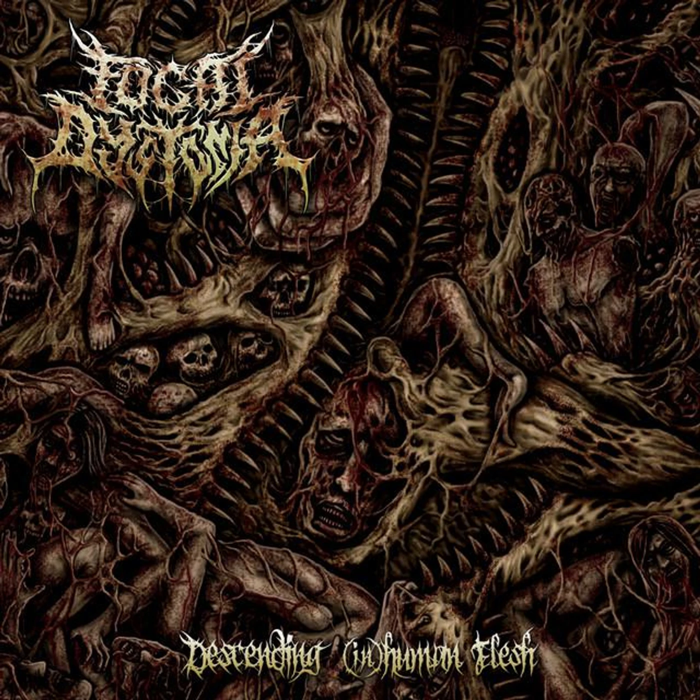 Focal Dystonia