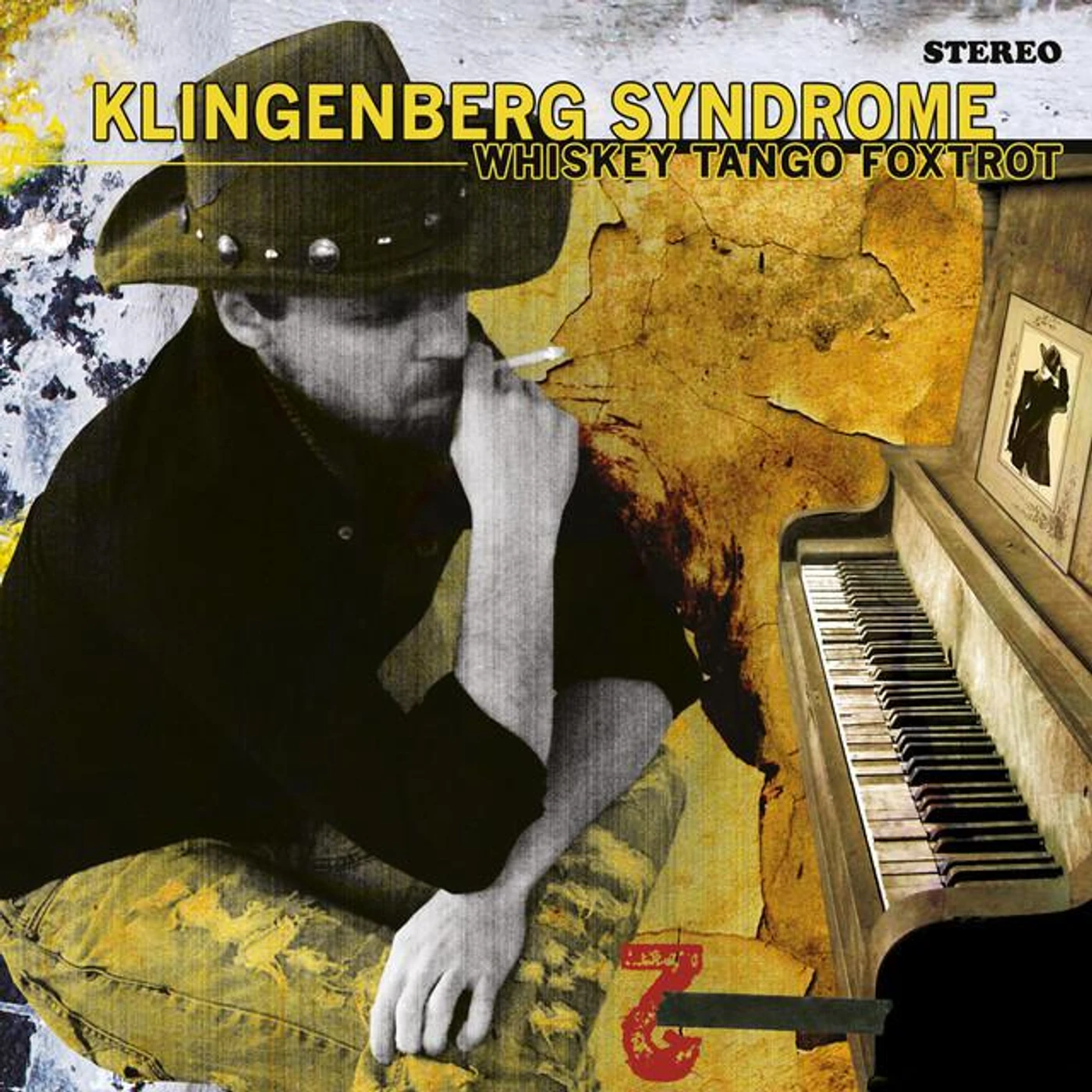 Klingenberg Syndrome