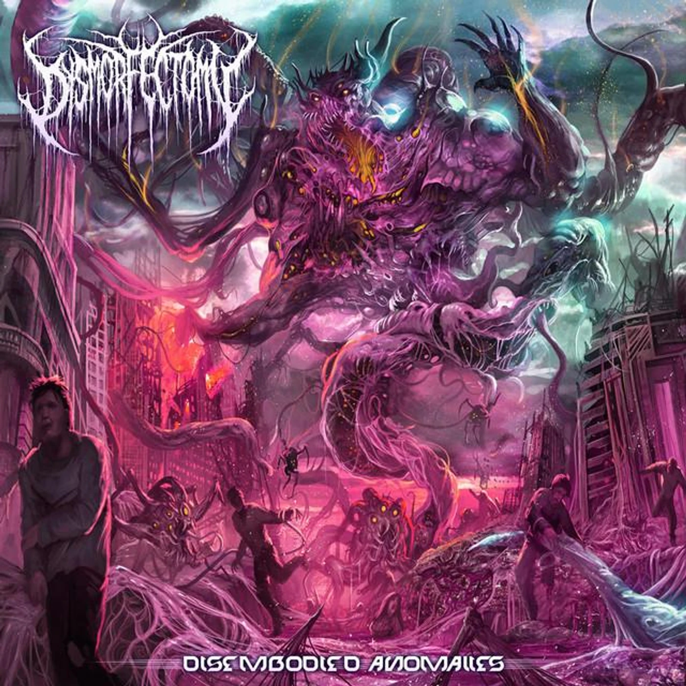 dysmorfectomy