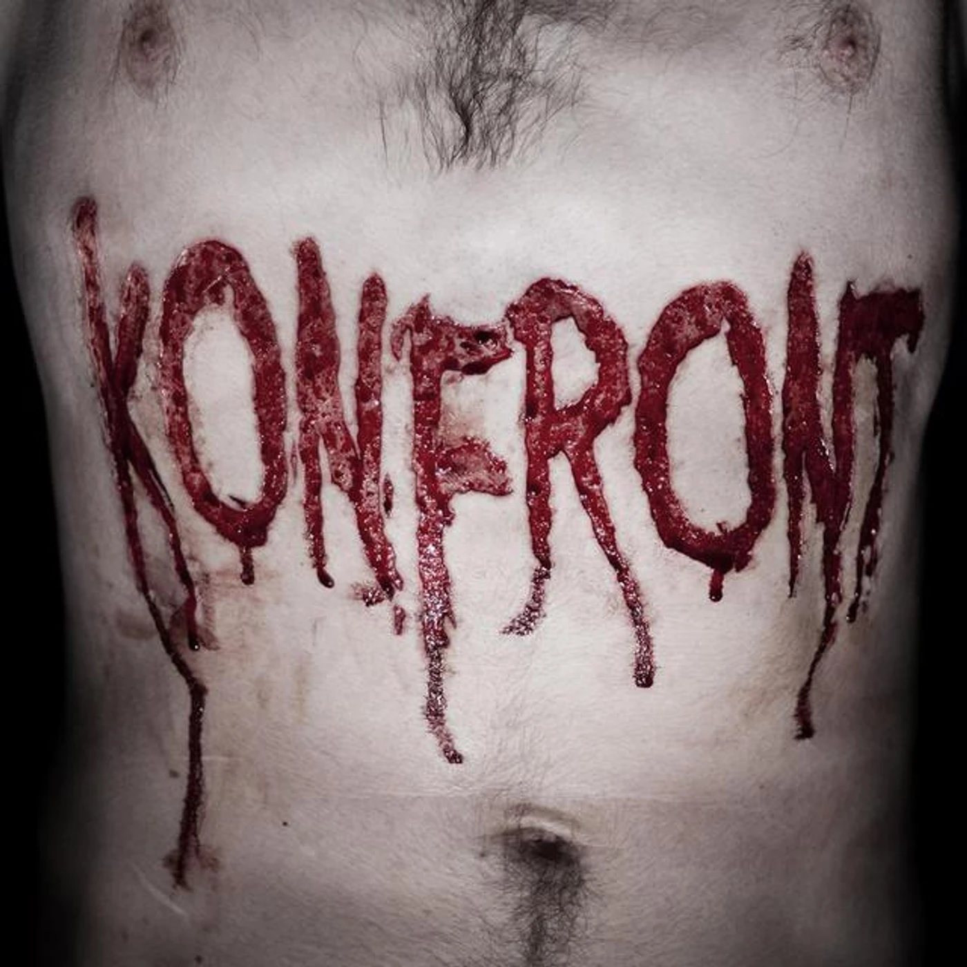 Konfront